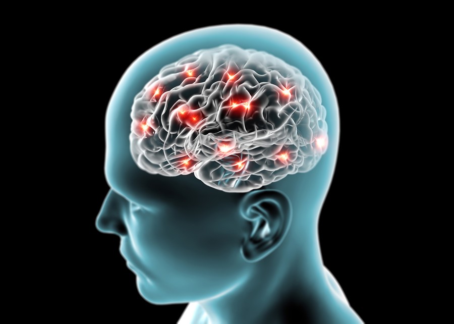 Tỷ lệ biến chứng não ở bệnh nhân COVID-19 nhập viện được tiết lộ trong nghiên cứu toàn cầu