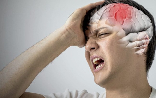 8 bệnh lý dễ nhầm lẫn với đột quỵ bạn cần đề phòng