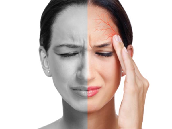 Đau đầu Migraine tiền triệu thường bị nhầm lẫn với đột quỵ não nhiều nhất