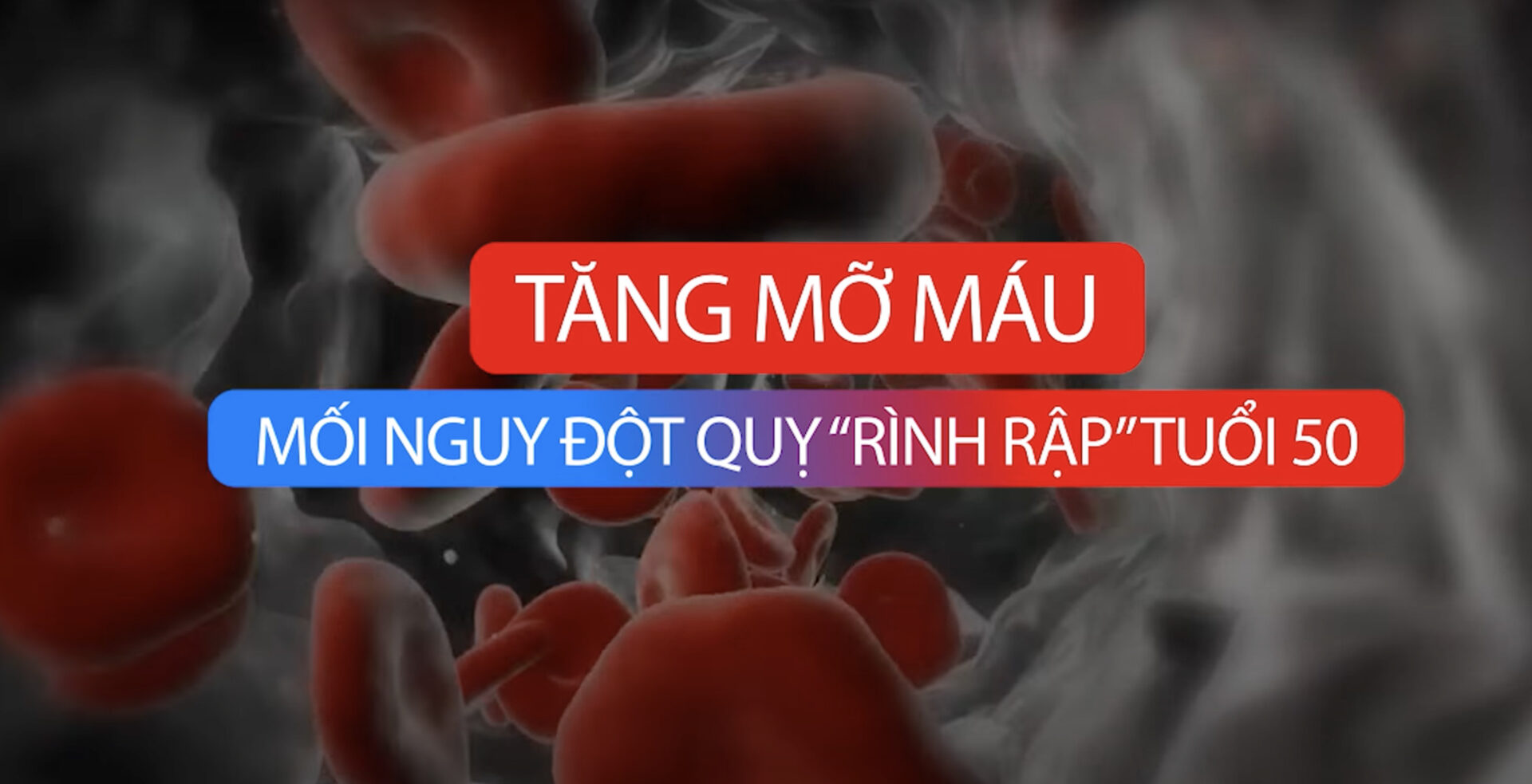 Tăng mỡ máu: Mối nguy đột quỵ rình rập tuổi 50