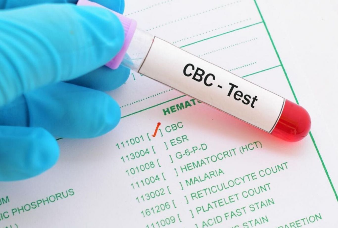 Vì sao nên làm xét nghiệm công thức máu toàn bộ?