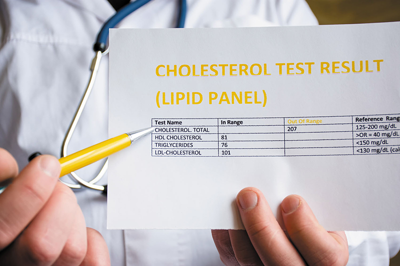 Xét nghiệm cholesterol và ý nghĩa của kết quả