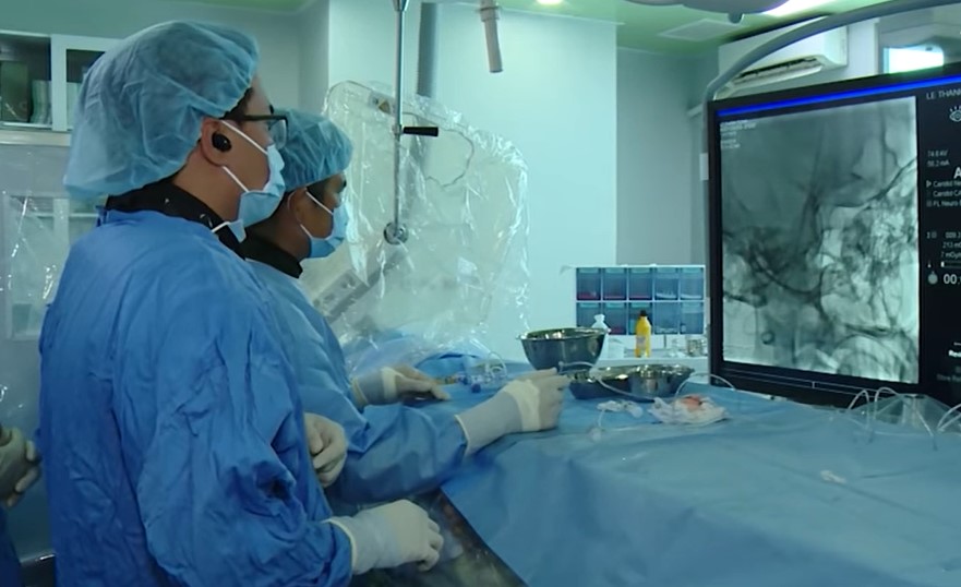 TS.BS Trần Chí Cường trong ca can thiệp đột quỵ cho bệnh nhân