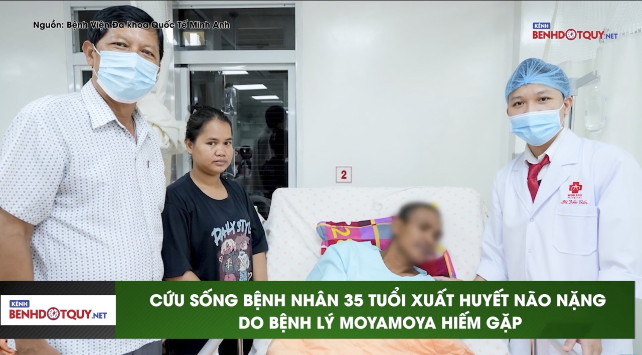 Nam bệnh nhân trẻ xuất huyết não thất do bệnh hiếm Moyamoya