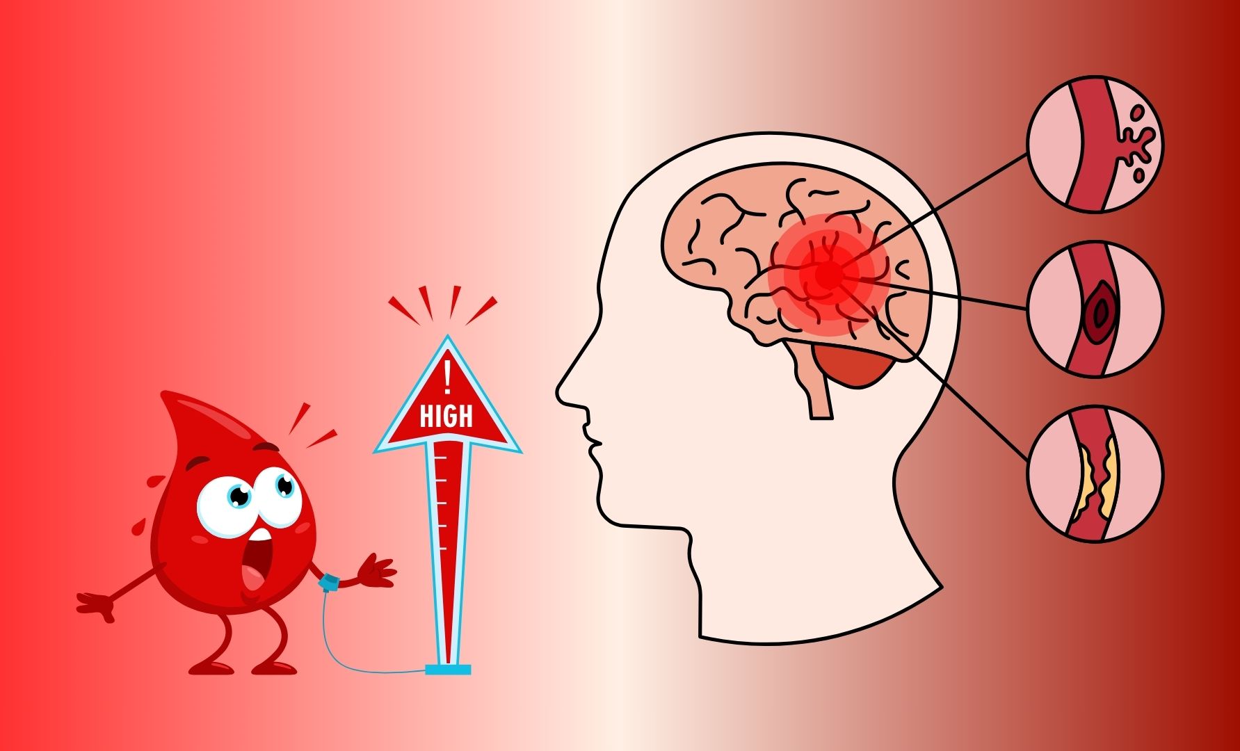 Không phải chỉ có huyết áp cao mới gây đột quỵ