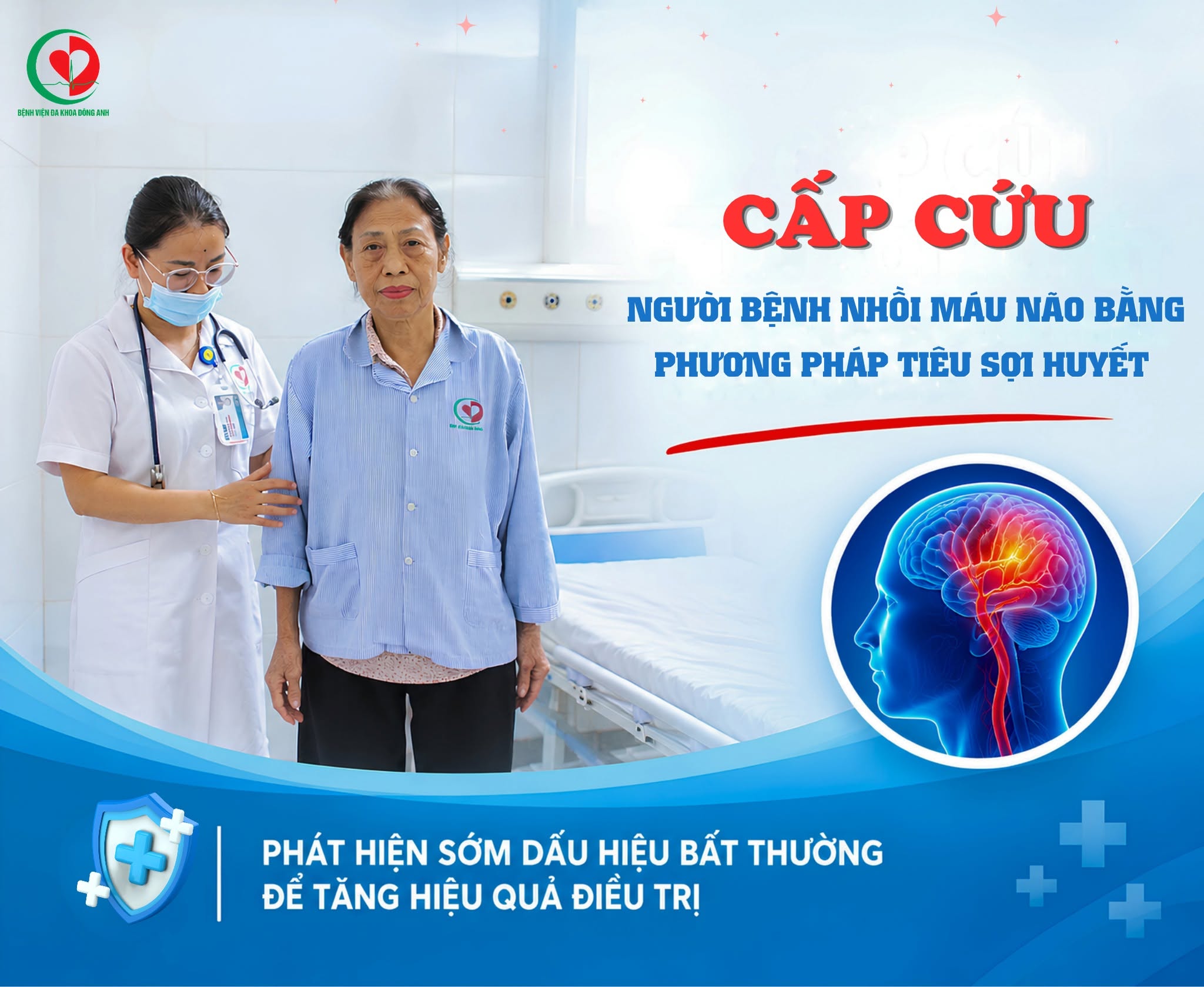 Điều trị thành công ca nhồi máu não bằng phương pháp tiêu sợi huyết